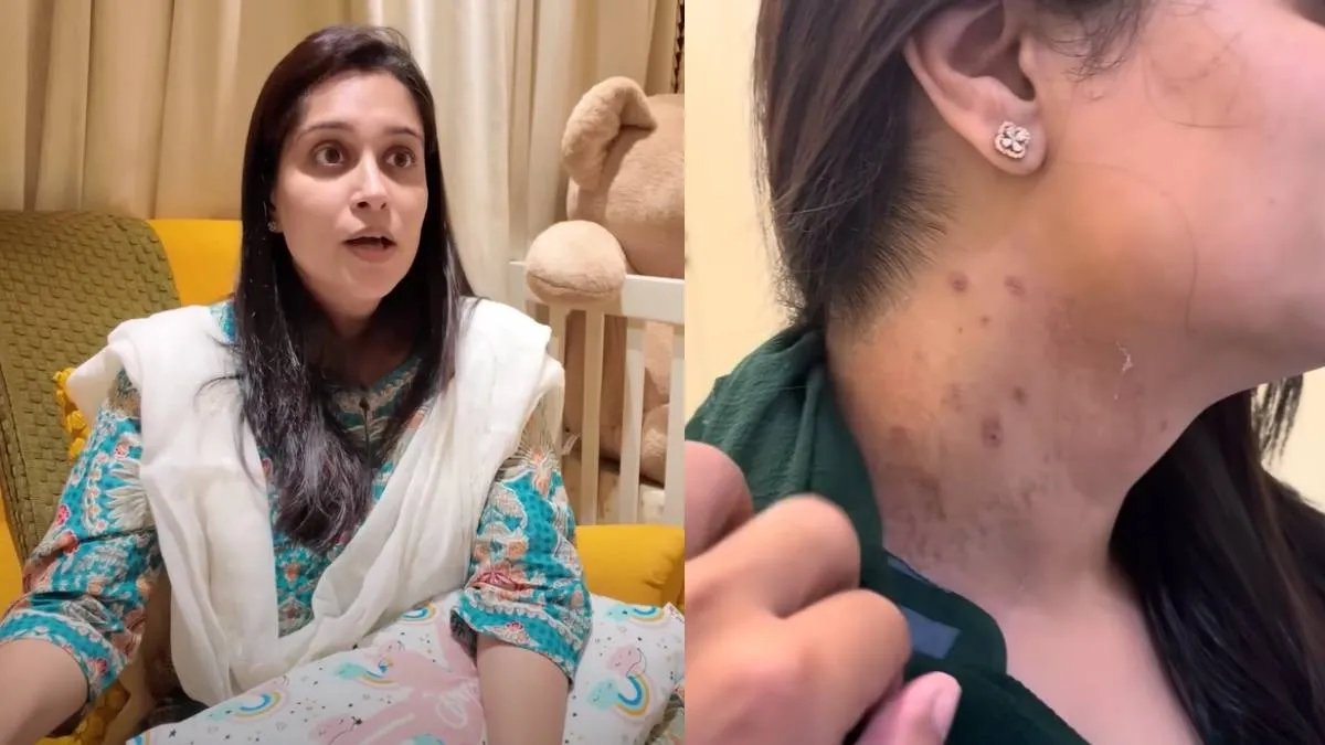 दीपिका काकर स्टेज 2 लीवर कैंसर सर्जरी के बाद पहला व्लॉग साझा करता है, इब्राहिम को उसका सबसे बड़ा समर्थक कहता है