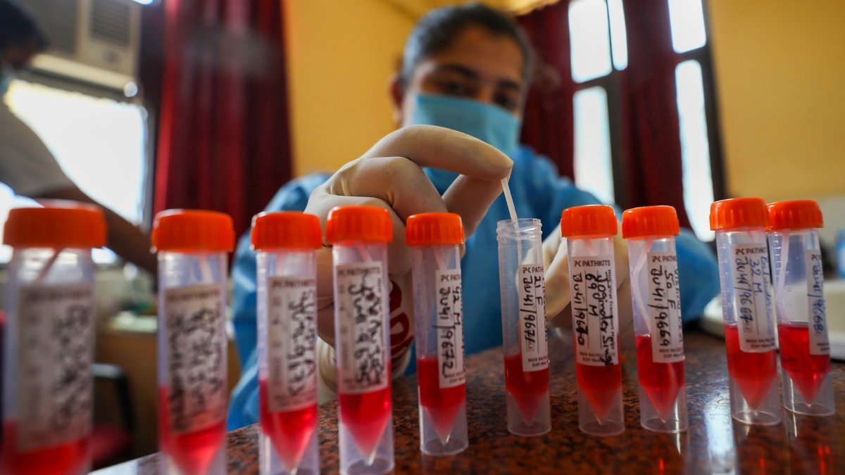 भारत ने 24 घंटे में 864 नए कोविड -19 मामलों की रिपोर्ट की, 4,300 से ऊपर सक्रिय टैली