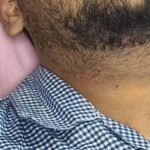 परिवार का कहना है कि गोली लगने से 19 वर्षीय युवक की दाहिनी आंख की रोशनी जा सकती है